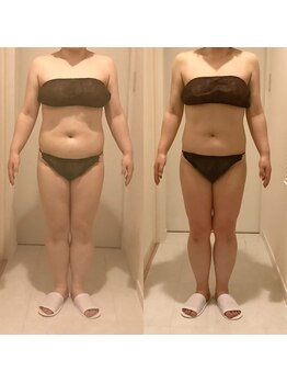 シエル(ciel)/before→after