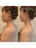 【ブライダル】顔のアイロンかけ/タイトニング/全顔・首・肩・肩甲骨