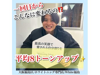 ホワイトニングサロン ホワイト(WHITE)/セルフホワイトニング/大阪/福島
