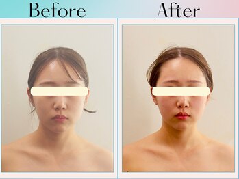 天空の手もみ/小顔矯正/吉祥寺/荻窪/西荻窪