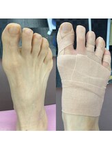 距骨サロン 東岡山店/【歩く度に痛い足・ひざの痛み】