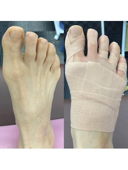 距骨サロン 東岡山店/【歩く度に痛い足・ひざの痛み】