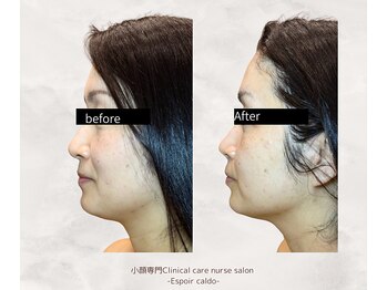 エスポワールカルド(Espoir caldo)/