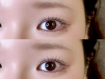 エムスリー つくば店(M3)/小顔効果*