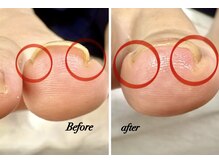 ラヴィ(La vie)の雰囲気（ワイヤー無しで巻き爪ケア痛み改善♪）