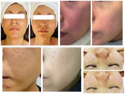 ペリドット(Peridot)の写真