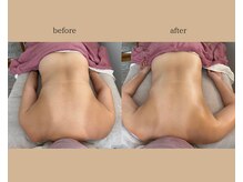 エン(en)/本音が溜まる背中を優しく浄化