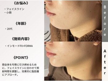 ルディラ 恵比寿店/インモードFX+FORMA