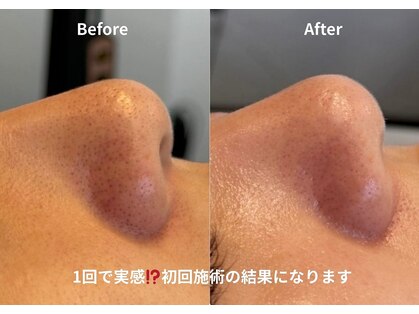 チョクチョクサロン(CHOKCHOK. Salon)の写真