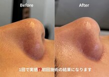 チョクチョクサロン(CHOKCHOK. Salon)