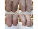 ◇フット角質ケア◇