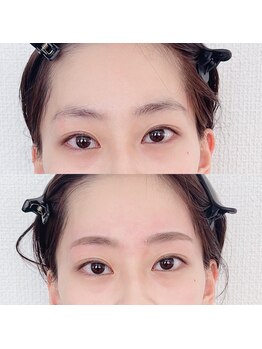 ララリア(lalalia)/整顔美眉