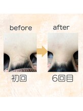 アンジェム(Angem)/変化がすごい！！！！