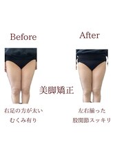 整体院トトノエル 西川原院/Before→After 