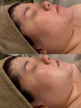 セレニテ(Serenite)/