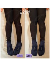 リセット(Reset)/フェムケア矯正