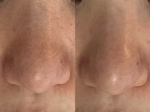 フェリノ(FERINO)/エンビロンポリッシング毛穴ケア