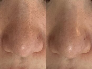 フェリノ(FERINO)/エンビロンポリッシング毛穴ケア