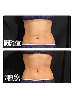 こねこのシッポ 虎ノ門/小顔も痩身もサーモシェイプDeep