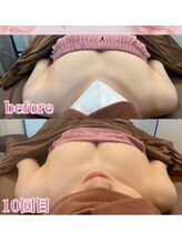 ロココ 豊田店(Rococo)/ビフォーアフター