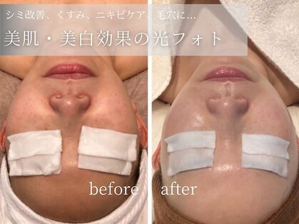 アイラブワン 大和 南林間店(eye love one)の写真