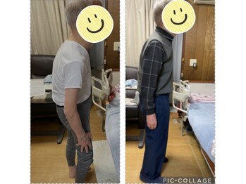 エンジョイエクササイズ整体院 武蔵新城(enjoyEXERCISE整体院)/Before、After