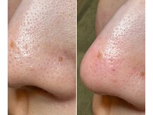 サイ(Sai)/before⇒after