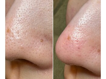 サイ(Sai)/before⇒after