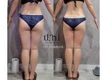 ユニ(uni.)/美脚ケア