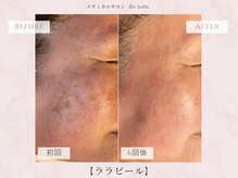ビベル 八木店(Bebelle)/肌が変わる40・50代本気の肌ケア