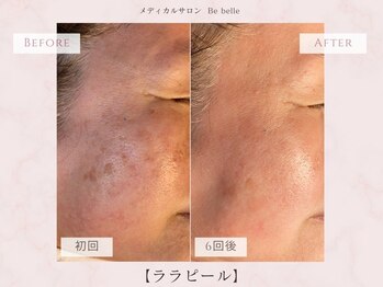ビベル 八木店(Bebelle)/肌が変わる40・50代本気の肌ケア