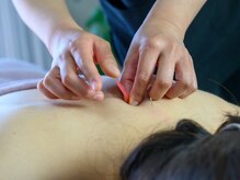 シミケアサロンShinの雰囲気（自律神経から整える美容鍼、即効性◎満足度◎）