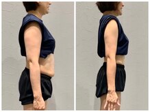 ネクストボディ レクト店(NEXTBODY)/【2ヶ月のビフォーアフター】