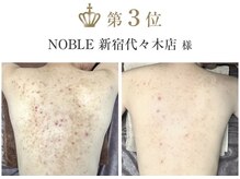 ノーブル(NOBLE)の雰囲気（クリニック監修コスメ使用で絶大な効果/ホームケア必要なし）