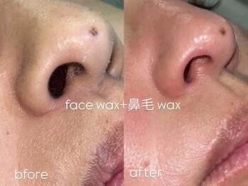 ハリウッドブロウリフト ワクシー 青山店(HOLLYWOOD BROW LIFT WAXYYY.)/たまごのようなツルん♪お肌に