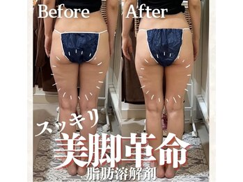 ラフィール/美脚・美尻になりたい