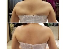 レゾン 京橋店/【Before/after】ブライダル