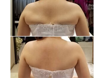 レゾン 京橋店/【Before/after】ブライダル