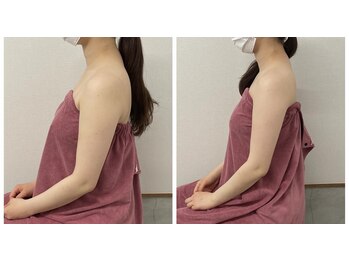 ブリランテ(Brillante)/