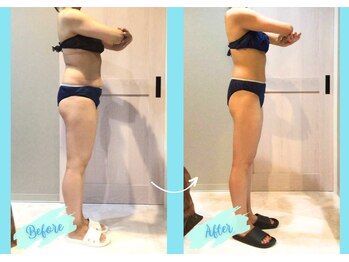 千歳の女神 西尾本店/【施術風景】Before/After