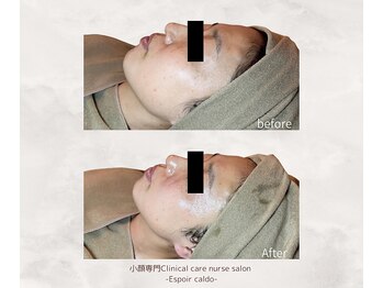 エスポワールカルド(Espoir caldo)/