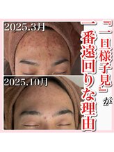 ホワイトアクア 天王寺本店(WHITE AQUA)/ハーブピーリング/大阪/天王寺