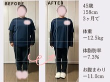 香林(KARIN)/ビフォーアフター