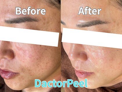 ベルシャトン(Belle Chaton)の写真