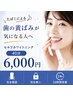 【たばこによる歯の黄ばみが気になる人】セルフホワイトニング40分 6,000円！
