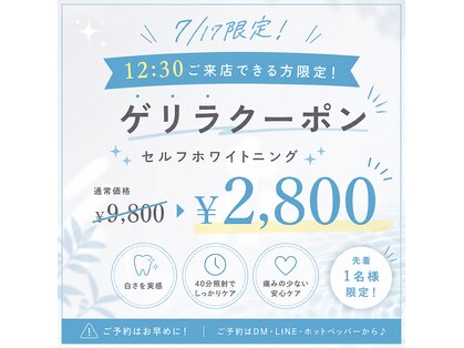 ホワイトニングショップ 香川丸亀店の写真