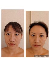 トータルエステティック ライム(lime)/爆上げ小顔正弦波フェイシャル◎