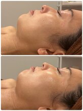 スリーズララ(Cerise LaLa)/