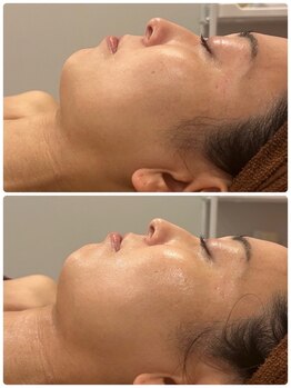 スリーズララ(Cerise LaLa)/