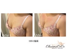 シャルムココ 蔵前店(CharmeCoCo)/お客様Before→After